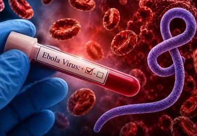 Bộ Y tế: Hướng dẫn chẩn đoán và điều trị bệnh do virus Ebola năm 2026