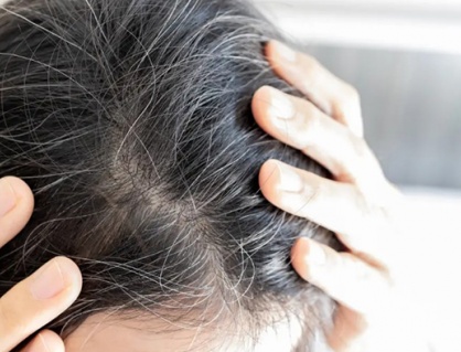 Cách làm chậm quá trình bạc tóc sớm