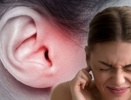 Béo phì có thể làm tăng nguy cơ mắc chứng ù tai?