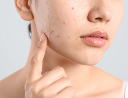 Làm thế nào để da mặt mịn màng khi thời tiết thay đổi?