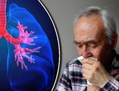 Người bị viêm phổi mạn tính nên điều trị như thế nào?