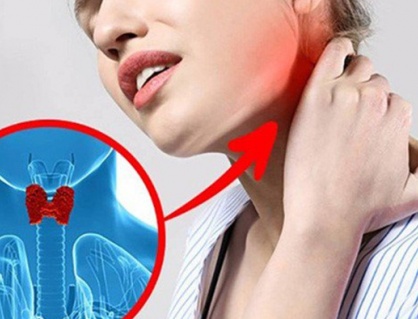 “Điểm mặt” dấu hiệu cảnh báo bệnh tuyến giáp