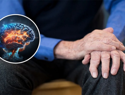 Run tay chân do thoái hóa và thiếu máu não nên xử trí theo hướng nào?