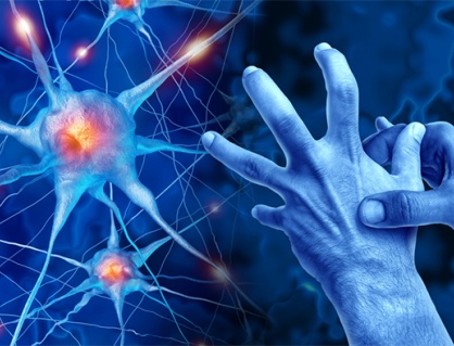 Run tay chân do thoái hóa não, dùng thuốc không cải thiện phải làm sao?