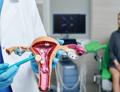 Mối liên hệ giữa u xơ tử cung và bệnh tim mạch ở phụ nữ