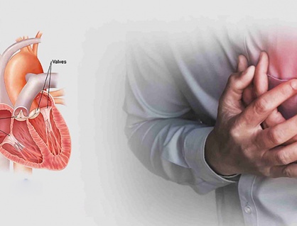 Hẹp van tim do thấp tim: Nguy cơ tiềm ẩn ở người trẻ