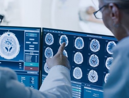 Thói quen có thể giúp “trẻ hóa” não bộ