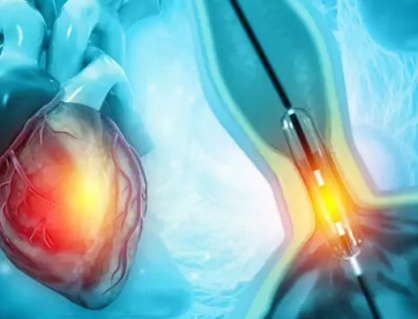 Hẹp mạch vành sau khi điều trị có tự hồi phục hoàn toàn không?