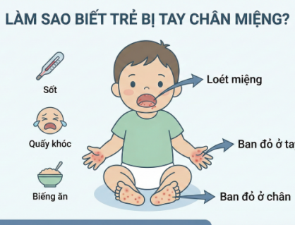 Làm sao để biết trẻ bị tay chân miệng?