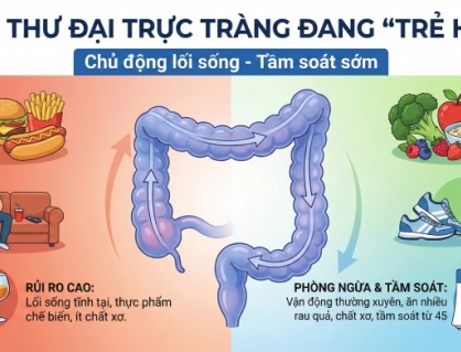 Khi nào người trẻ cần đi tầm soát ung thư đại trực tràng?