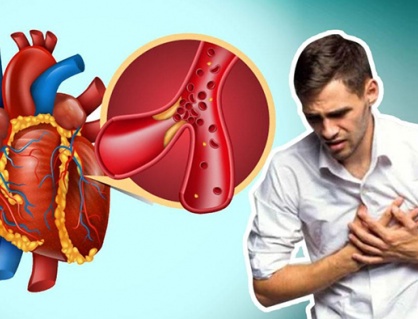 Thói quen hàng ngày đang âm thầm “tàn phá” sức khỏe tim 