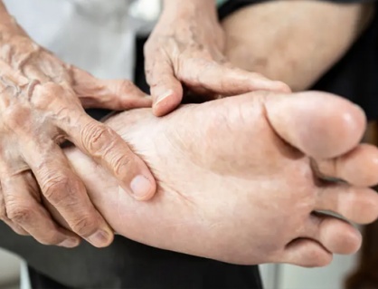 Làm sao phòng ngừa biến chứng bàn chân cho người bệnh đái tháo đường?