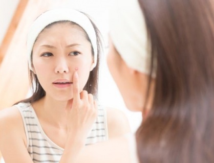 Những thành phần mỹ phẩm không dành cho da mụn