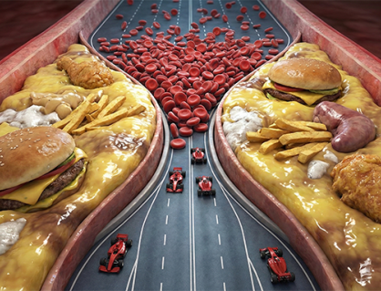 4 nhóm thực phẩm khiến cholesterol máu tăng vọt