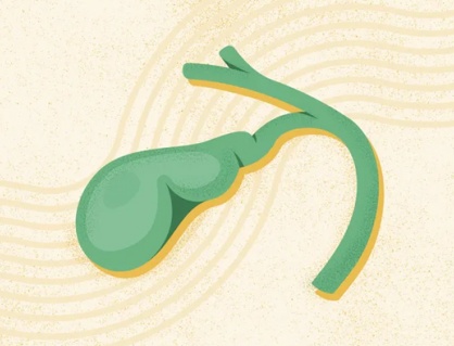 Có sỏi mật 15mm, hay bị đau hạ sườn phải nên xử trí thế nào?