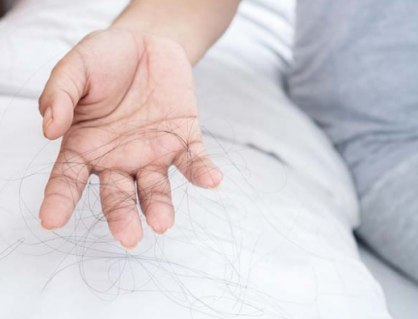 Vỏ gối và thói quen ngủ có liên quan đến rụng tóc?