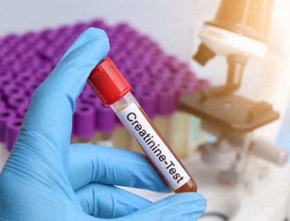 Tại sao chỉ số creatinin lúc tăng lúc giảm?