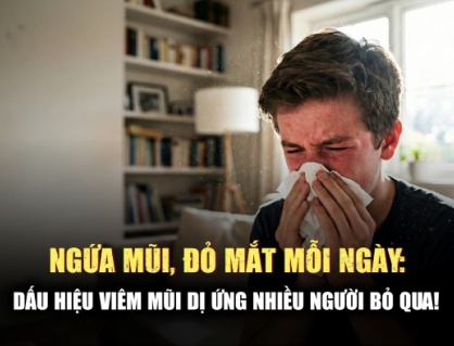 Hắt xì hơi liên tục, ngứa mắt: Có phải viêm mũi dị ứng?