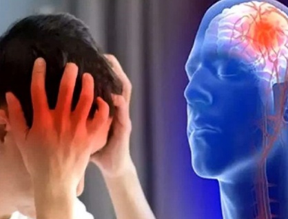 Tai biến mạch máu não có mấy loại?