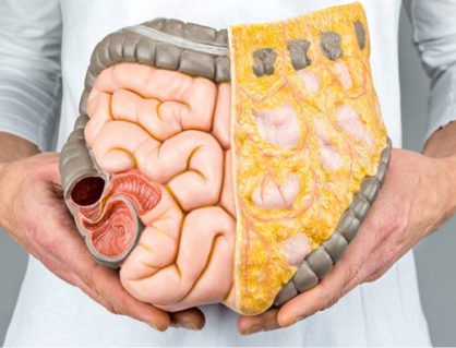 6 dưỡng chất giúp kiểm soát mỡ nội tạng