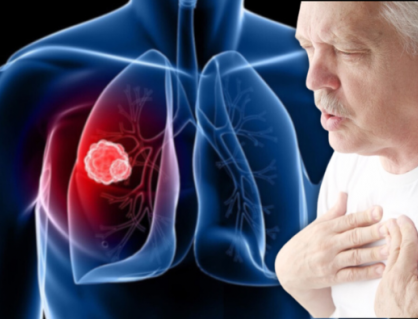 Cách kiểm soát triệu chứng khó thở do u phổi