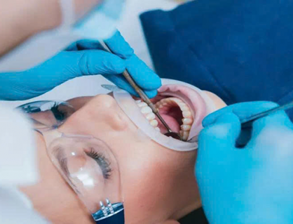 WHO ban hành hướng dẫn mới về phòng và điều trị sâu răng