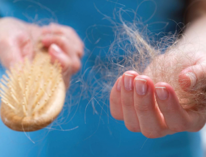 Nhận biết sớm dấu hiệu rụng tóc và cách hạn chế