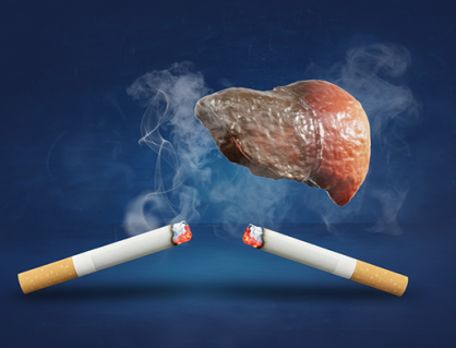 Không chỉ hại phổi, hút thuốc còn gây tổn thương gan