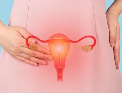 “Điểm mặt” dấu hiệu ung thư buồng trứng