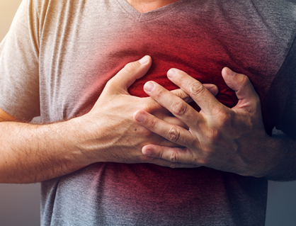 Hẹp mạch vành 45% có cần đặt stent không?