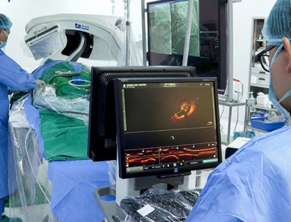 Điều trị vôi hóa động mạch vành bằng sóng xung kích