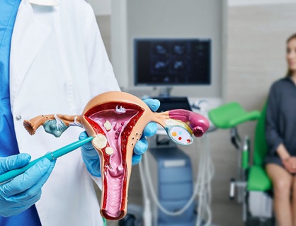 Các yếu tố ảnh hưởng đến u xơ tử cung sau tuổi 30