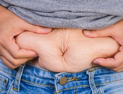 Tăng nguy cơ mắc nhiều loại ung thư do béo phì