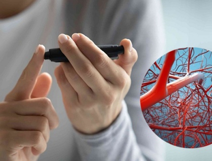 Mắc đái tháo đường: Cần biết gì về biến chứng mạch máu nhỏ của bệnh?