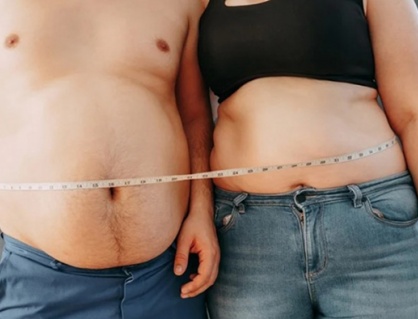 Béo phì trước tuổi 30 làm tăng nguy cơ tử vong sớm