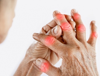 6 bí quyết kiểm soát acid uric, ngăn chặn cơn đau gout cấp