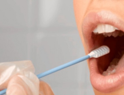 Xét nghiệm nước bọt tại nhà giúp phát hiện sớm ung thư dạ dày