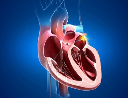 Đốt điện tim rồi vẫn tái phát, có nên tiếp tục can thiệp hay chuyển hướng khác?