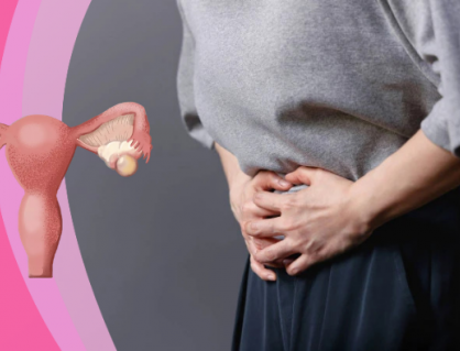 Giải pháp giúp kiểm soát u nang buồng trứng an toàn 