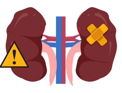 Suy thận độ 1 biểu hiện như thế nào?