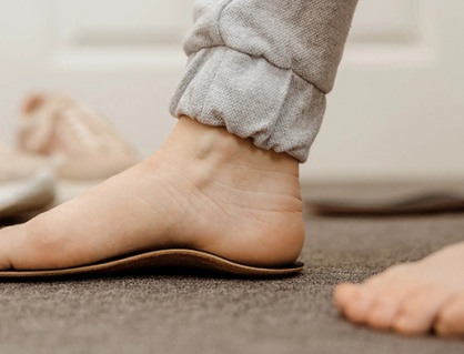 Nguy cơ sức khỏe đi cùng đôi bàn chân bẹt