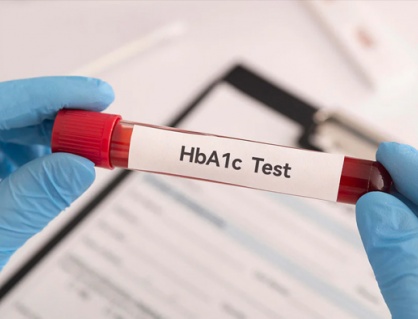 Đái tháo đường, chỉ số HbA1c 7,5% có nguy hiểm không?