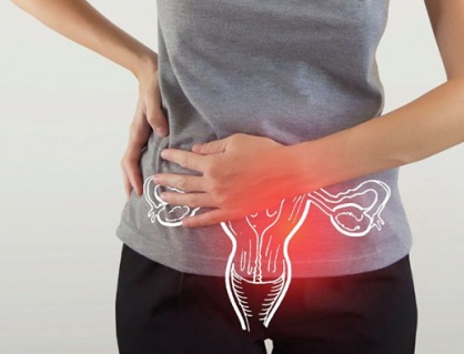 U nang buồng trứng có gây ra khí hư bất thường?