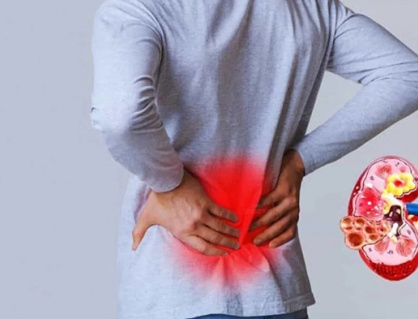 Thận yếu: Làm sao để bảo vệ chức năng thận? 