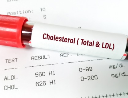 Ăn uống bình thường vẫn tăng cholesterol máu: Nguyên nhân từ đâu?
