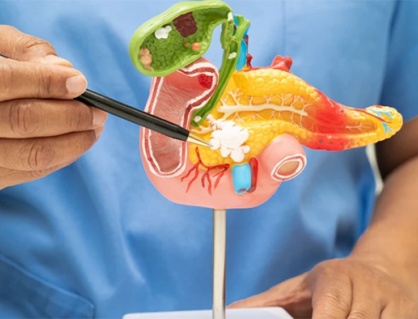 Làm thế nào để nhận ra dấu hiệu cảnh báo sỏi mật giai đoạn đầu?