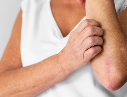 Người bệnh đái tháo đường bị ngứa có cách gì cải thiện được không?