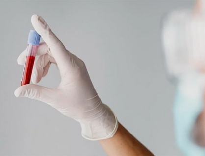 Tại sao đường huyết ổn định nhưng HbA1c vẫn cao?