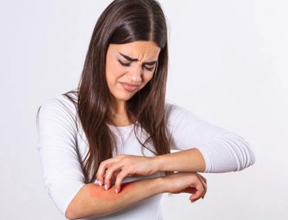Vảy nến và những ảnh hưởng ít ai ngờ tới
