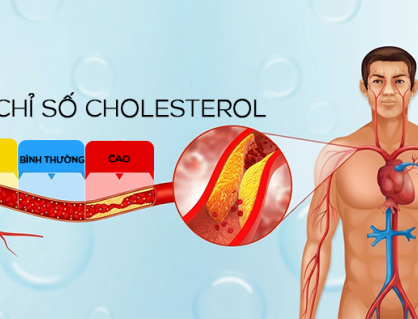 Tăng cholesterol kéo dài: Mối nguy âm thầm thúc đẩy xơ vữa động mạch